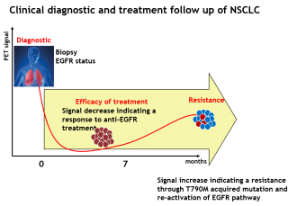 IMAkinib radiotraceur EGFR suivi clinique